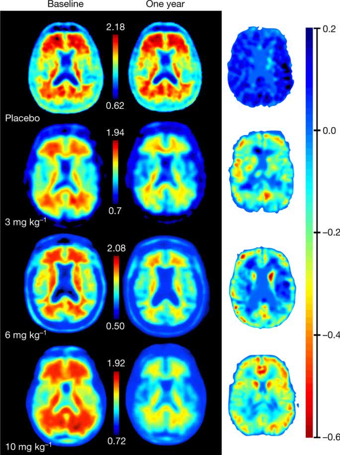 Biogen Hits A Wall, What's Next? (NASDAQ:BIIB) | Seeking Alpha