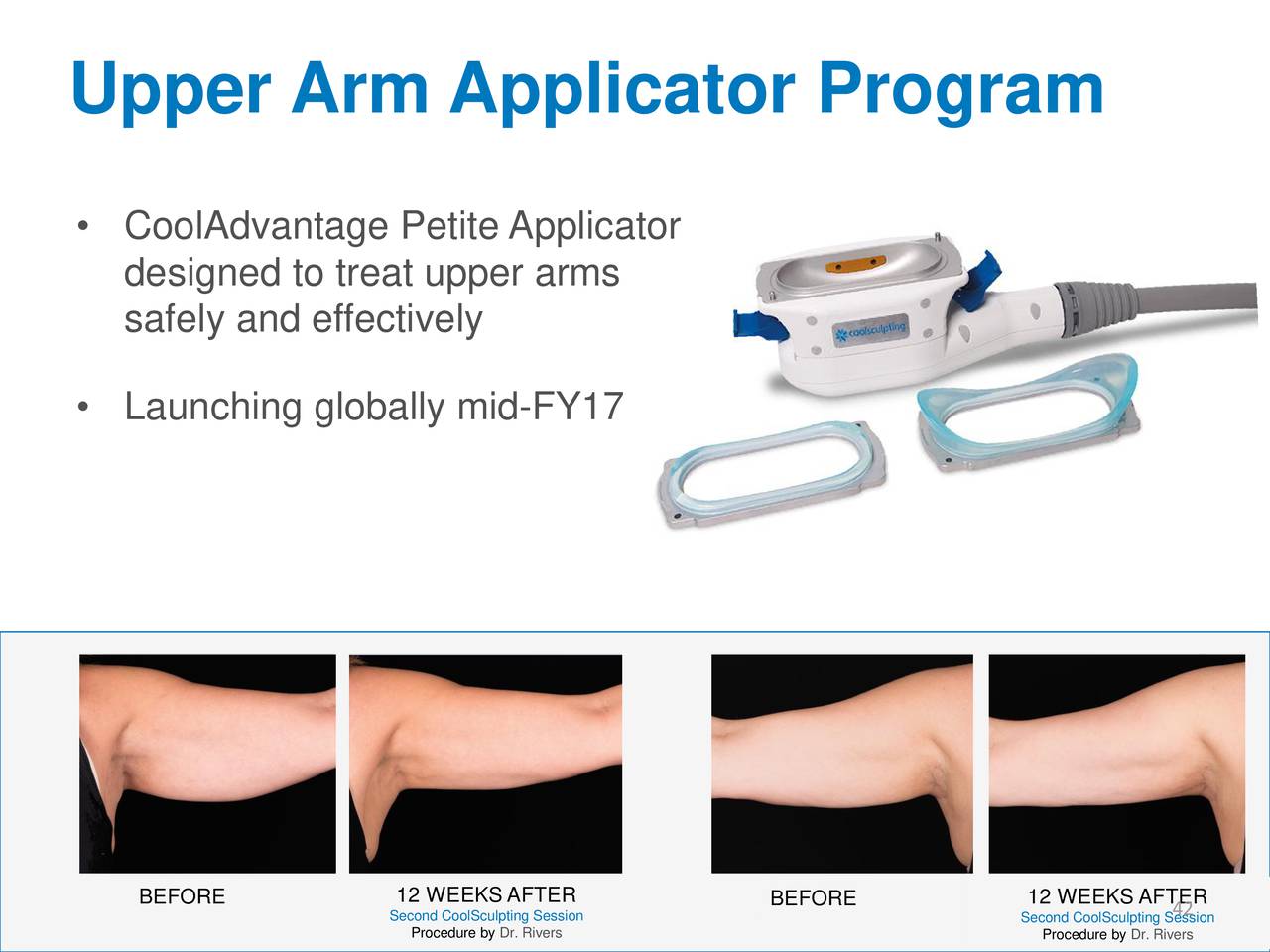 ZELTIQ Aesthetics (ZLTQ) presents at J.P. Healthcare Conference