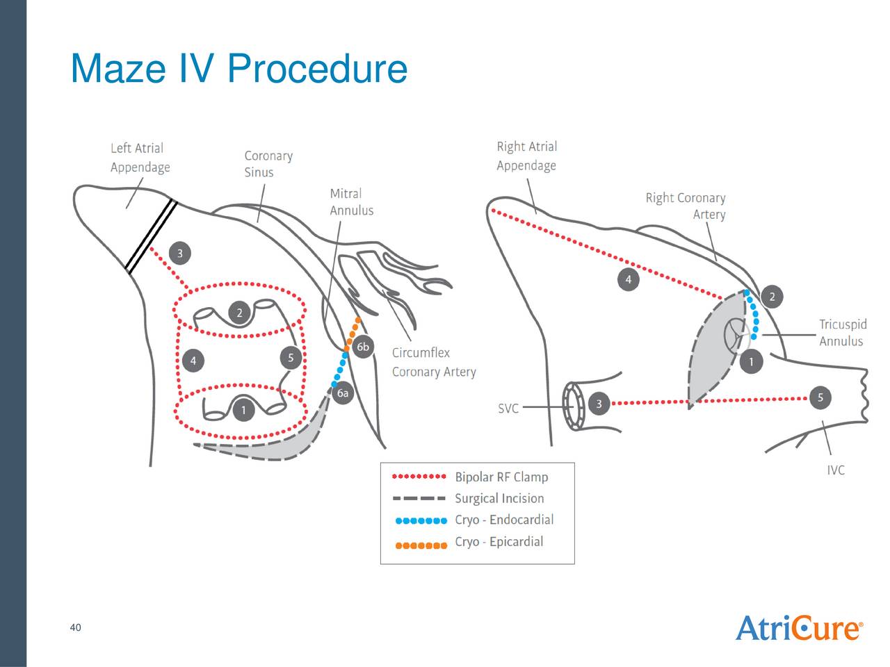 AtriCure, Inc. 2016 Q4 Results Earnings Call Slides (NASDAQATRC