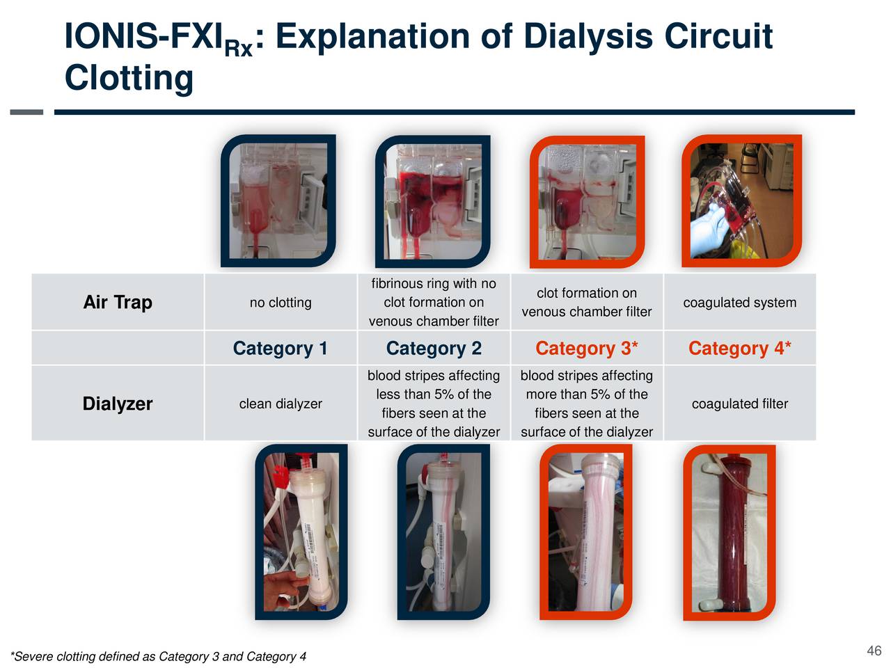 Ionis Pharmaceuticals (IONS) Investor Presentation Slideshow Ionis