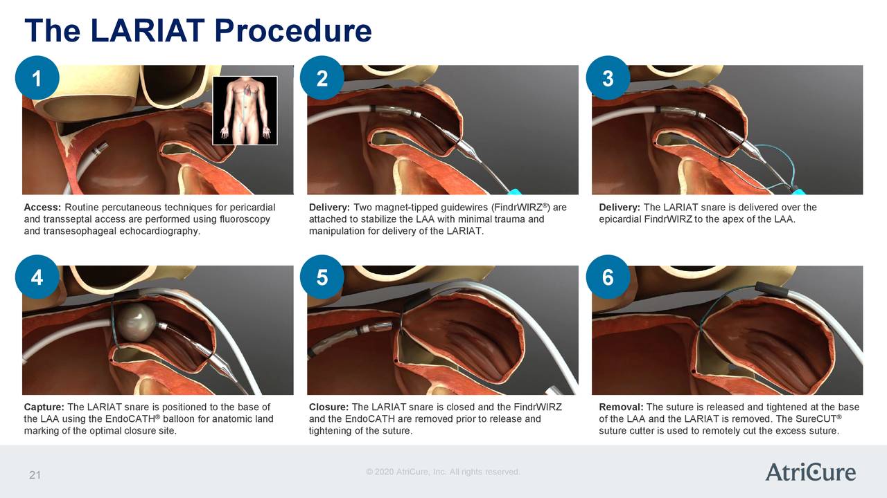 ar processes lasso procedure