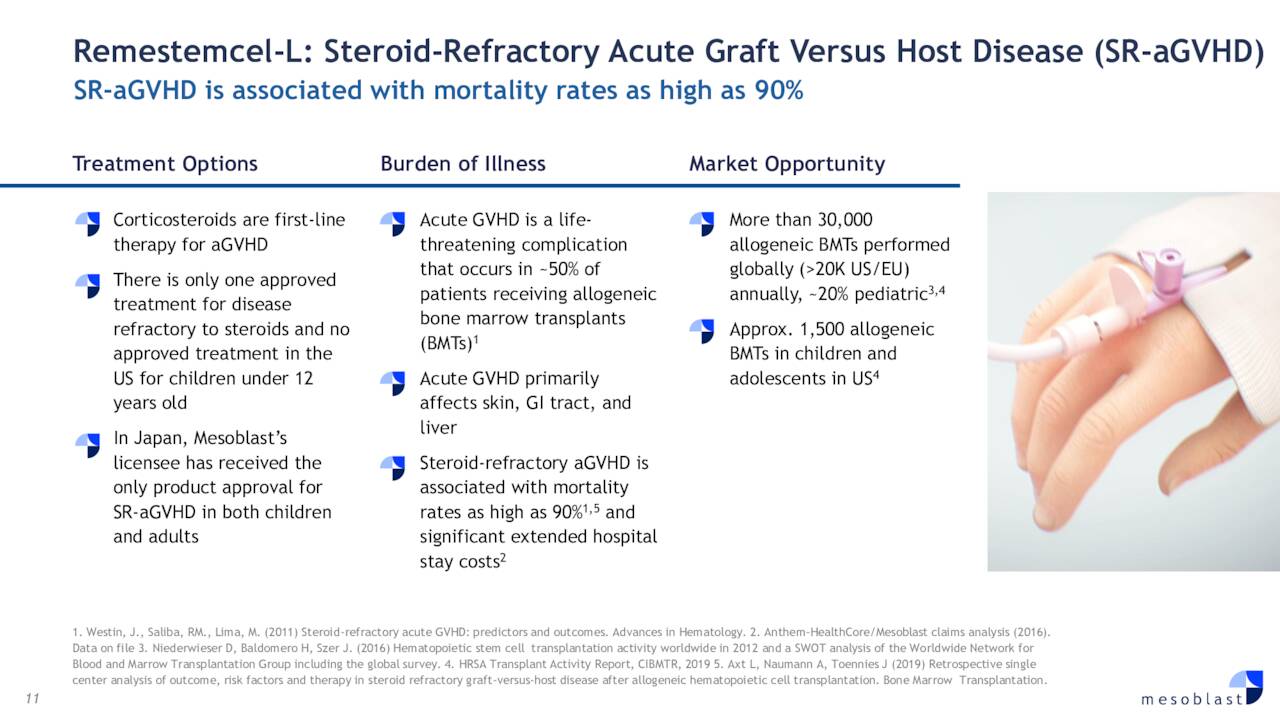 Remestemcel-L: Steroid-refractory acute graft-versus-host disease (SR-aGVHD)