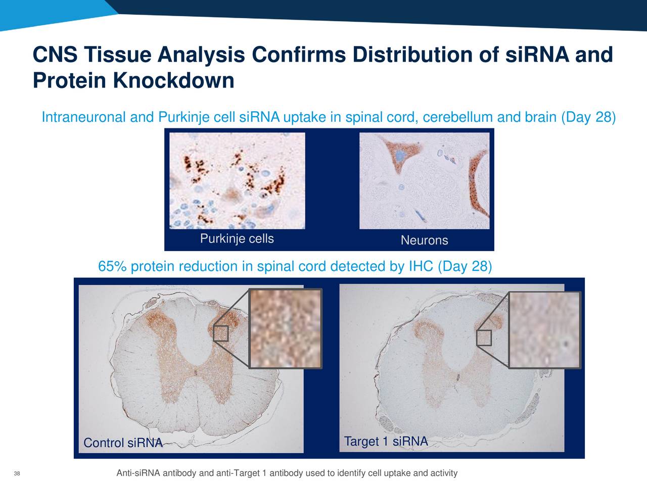 Alnylam Pharmaceuticals (ALNY) Platform Advances In RNAi Therapeutics ...